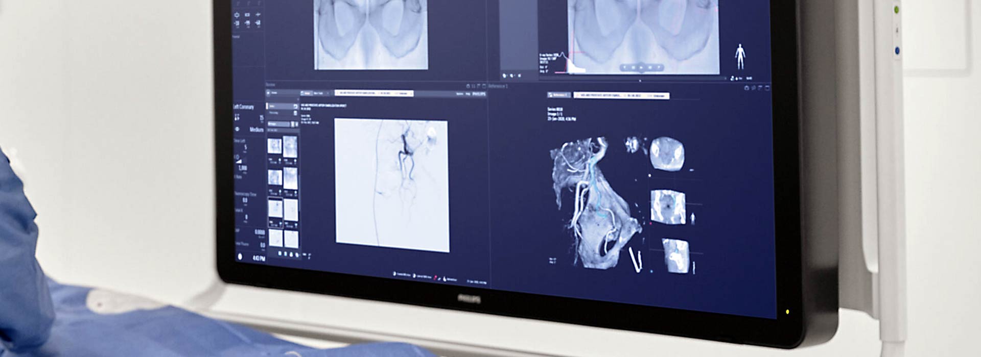 Dottor Franco Valenza Radiologo Interventista