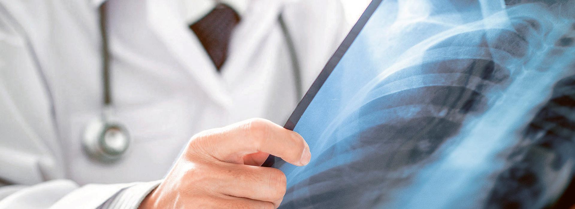 Dottor Franco Valenza radiologo interventista